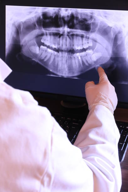 Best Emergency Dentist for Knocked-Out Tooth in Sag Harbor, NY